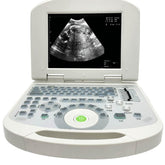 Portable all-digital notebook medical ultrasound scanner + convex array probe